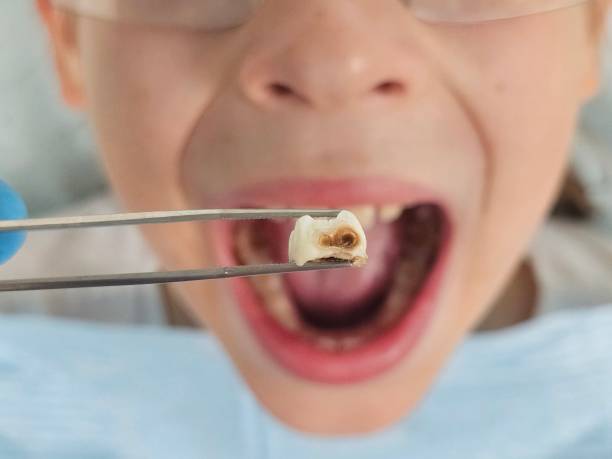 Best Pediatric Emergency Dentist in Dunsmuir, CA